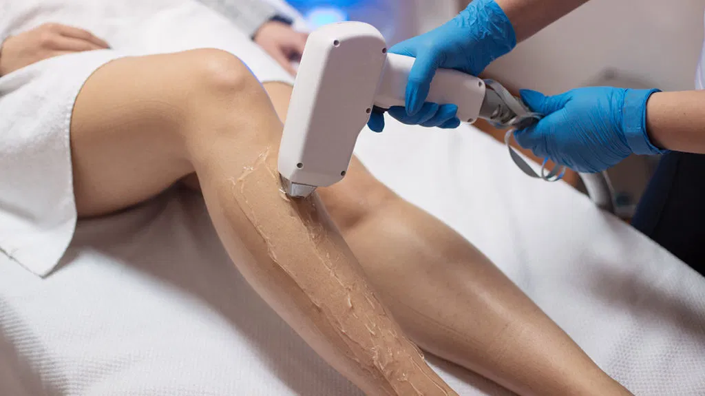 What to Anticipate During Under Arm Hair Removal Treatment?